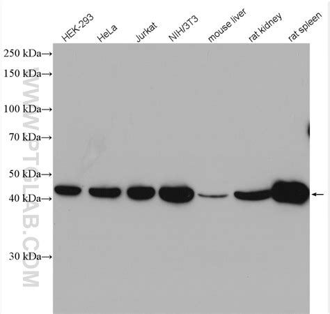 Beta Actin antibody (20536.
